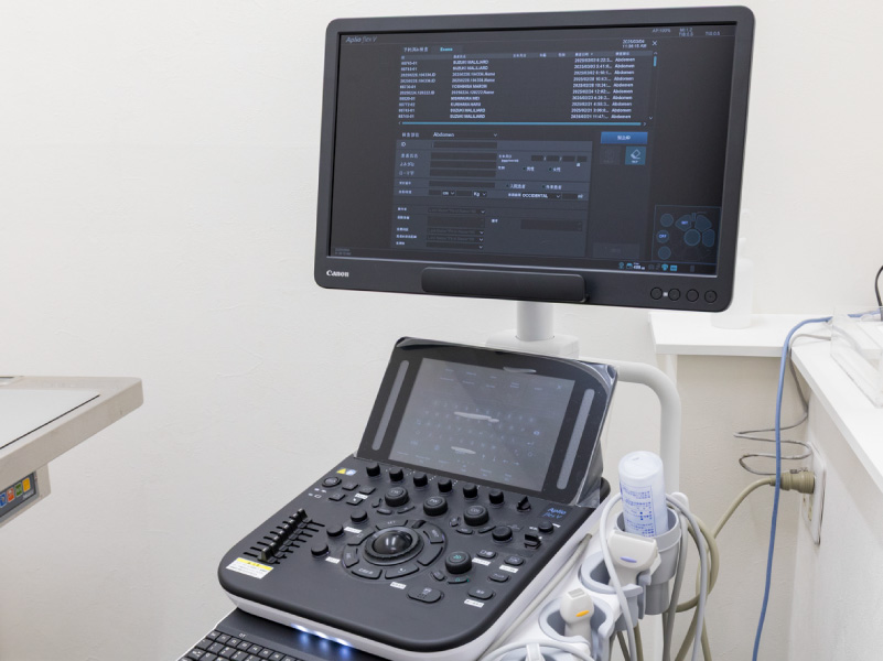 超音波診断装置（エコー）